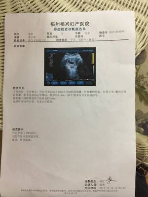 帶著7周的B超進來猜猜男女吧!