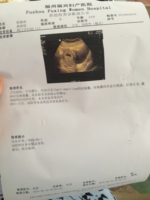 好擔心。怎么辦