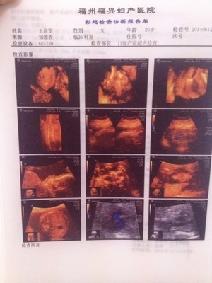 福州媽媽圈熱議 看看是男是女，福興婦產(chǎn)醫(yī)院的科學(xué)性別鑒定指南